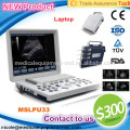 MSLPU33-I ordinateur portable B / W machines à ultrasons pour le test de grossesse avec de bonnes images
